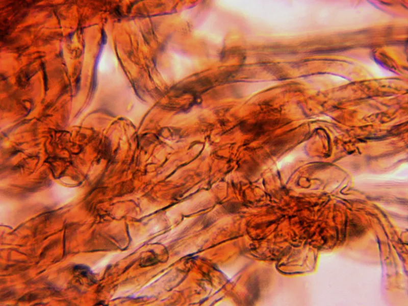 Clavariadelphus pistillaris 9 - Hifas trama